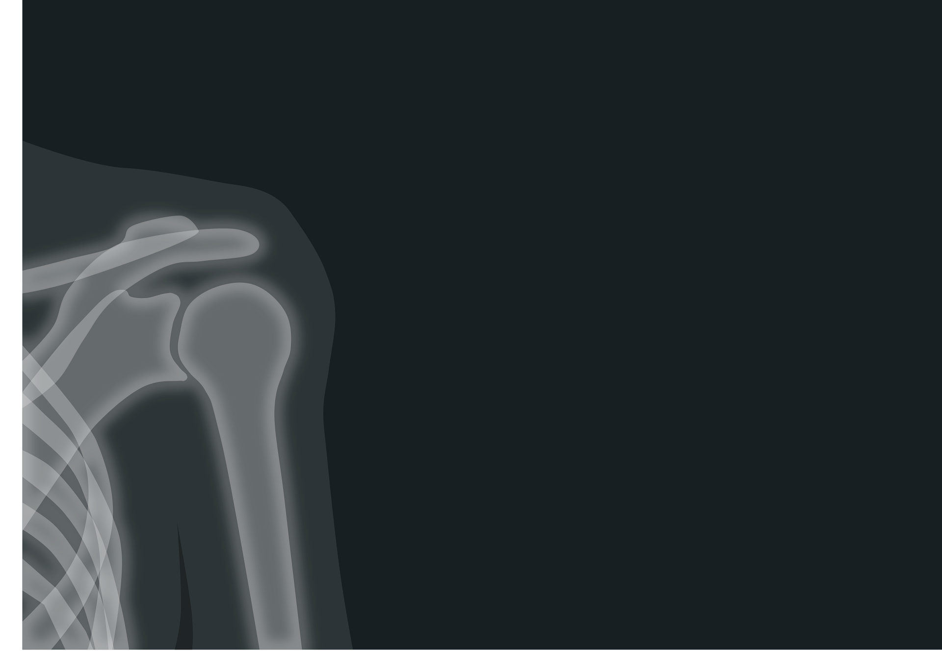 An X-ray of a shoulder.